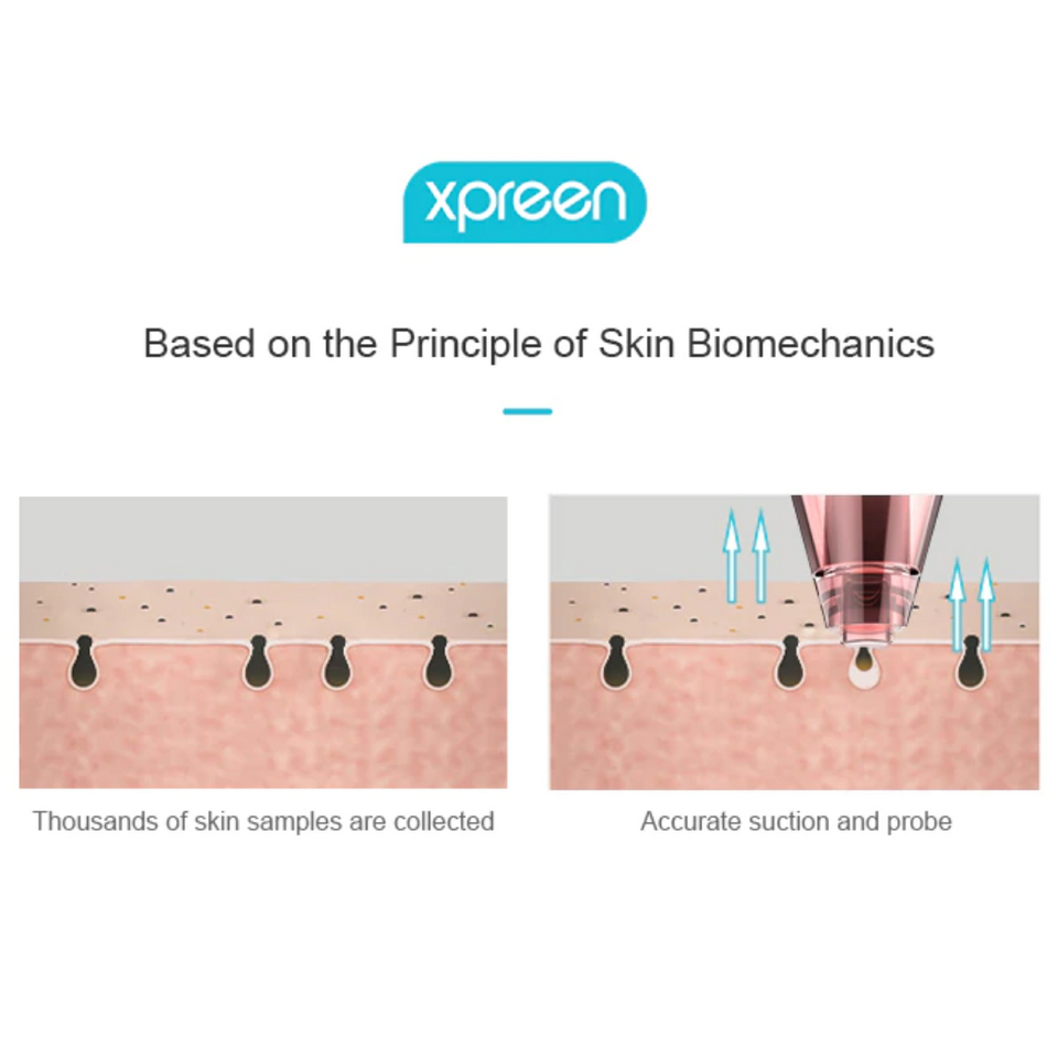 Limpeza e Remoção de Cravo e Acne